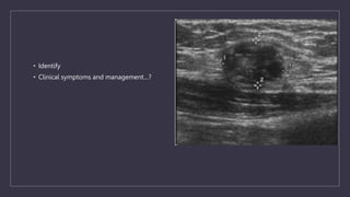 • Identify
• Clinical symptoms and management…?
 