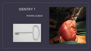 MYOMA SCREW
IDENTIFY ?
 