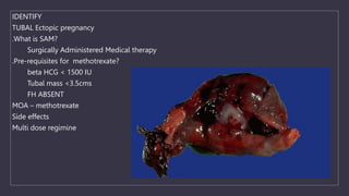 IDENTIFY
TUBAL Ectopic pregnancy
.What is SAM?
Surgically Administered Medical therapy
.Pre-requisites for methotrexate?
beta HCG < 1500 IU
Tubal mass <3.5cms
FH ABSENT
MOA – methotrexate
Side effects
Multi dose regimine
 