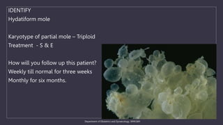 Department of Obstetrics and Gynaecology, SRMC&RI
IDENTIFY
Hydatiform mole
Karyotype of partial mole – Triploid
Treatment - S & E
How will you follow up this patient?
Weekly till normal for three weeks
Monthly for six months.
 