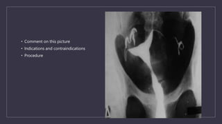 • Comment on this picture
• Indications and contraindications
• Procedure
 