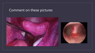 Comment on these pictures
 