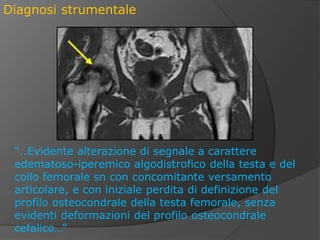 Cucchiaino Chirurgico Hatt Per Taglio Legamenti QSWTITAN - Strumento Per Artroplastica Escissionale Testa Femorale Cane Gatto