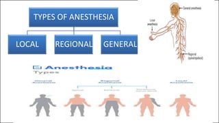TYPES OF ANESTHESIA
LOCAL REGIONAL GENERAL
 