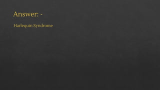 Answer: -
Harlequin Syndrome
 