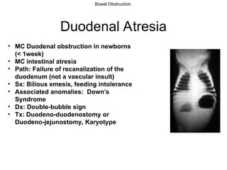 PGY101-Chapter-48-Ileus-and-Bowel-Obstruction-Copy.ppt