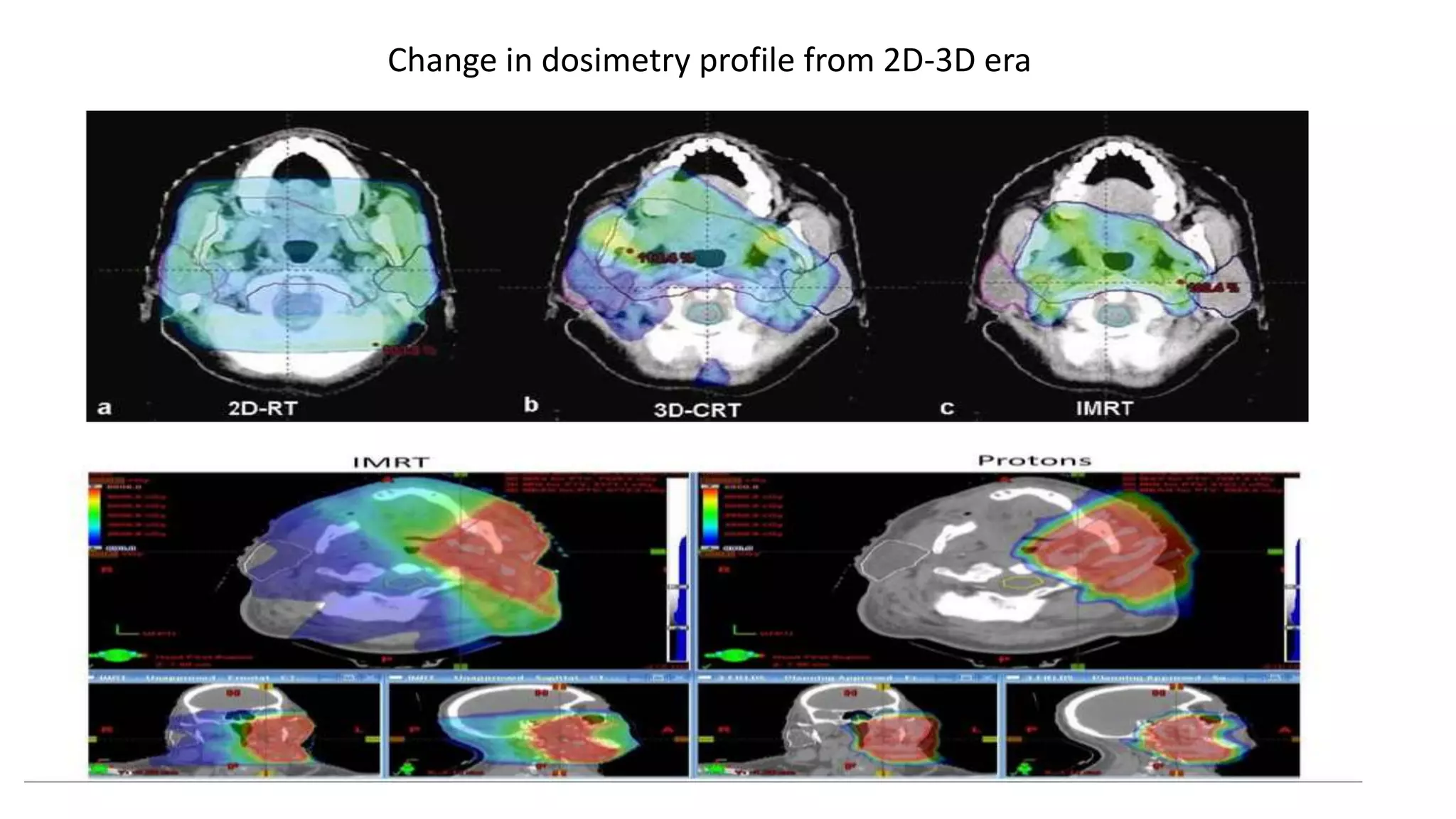 Photon Vs proton beam therapy | PPTX