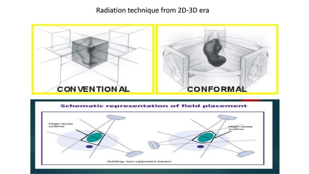 Photon Vs proton beam therapy | PPT