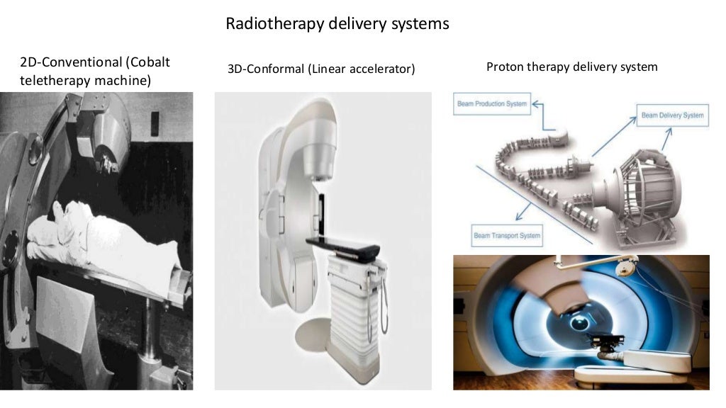 Photon Vs proton beam therapy