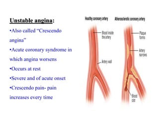 Unstable angina:
•Also called “Crescendo
angina”
•Acute coronary syndrome in
which angina worsens
•Occurs at rest
•Severe and of acute onset
•Crescendo pain- pain
increases every time
 