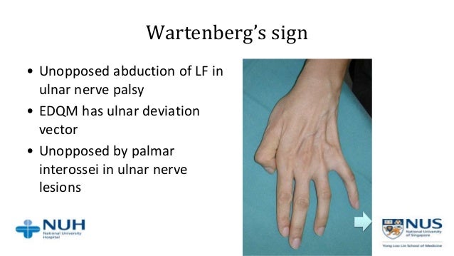 approach to hand conditions ulnar nerve palsy