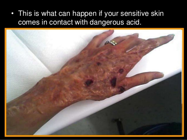 what is something that affects the strength of both acids and bases