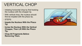 VERTICAL CHOP
◦ initiating horizontal chop by first hooking
the nucleus with the chopper tip.
◦ With vertical chop, the nucleus should
first be impaled with the phaco tip.
◦ STEPS:
◦ Impale the Nucleus With the Phaco
Tip
◦ Incise the Nucleus With the Vertical
Chopper, Then Lift With the Phaco
Tip.
◦ Chop All Fragments Before
Removing Them.
 