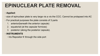 EPINUCLEAR PLATE REMOVAL
◦ Applied:
◦ size of epinuclear plate is very large vis a vis the CCC. Cannot be prolapsed into AC
◦ For practical purposes the plate consists of 3 parts
1. anterior(beneath the anterior capsule)
2. equatorial (at the capsular fornices)
3. posterior (along the posterior capsule).
◦ INSTRUMENTS
◦ Iris Repositor through the side port
 