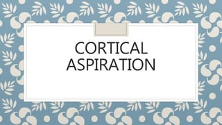 CORTICAL
ASPIRATION
 