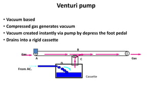 Venturi pump
• Vacuum based
• Compressed gas generates vacuum
• Vacuum created instantly via pump by depress the foot pedal
• Drains into a rigid cassette
 