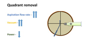 Quadrant removal
Aspiration flow rate -
Vacuum -
Power -
 
