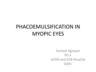 PHACOEMULSIFICATION IN
MYOPIC EYES
Sumeet Agrawal
PG 3
UCMS and GTB Hospital
Delhi
 