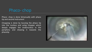Bimanually Phacoemulsification Prakash Bam.pptx