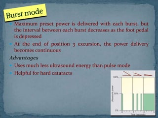  Maximum preset power is delivered with each burst, but
the interval between each burst decreases as the foot pedal
is depressed
 At the end of position 3 excursion, the power delivery
becomes continuous
Advantages
 Uses much less ultrasound energy than pulse mode
 Helpful for hard cataracts
 