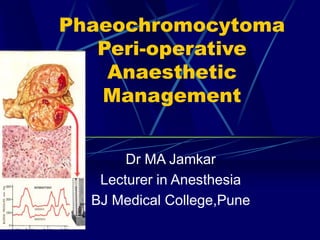 Phaeochromocytoma
Peri-operative
Anaesthetic
Management
Dr MA Jamkar
Lecturer in Anesthesia
BJ Medical College,Pune
 