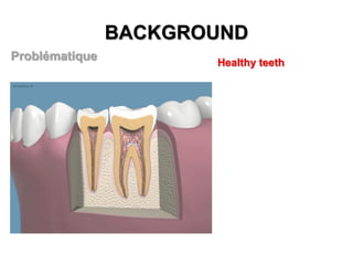 BACKGROUND
Problématique

Healthy teeth

 