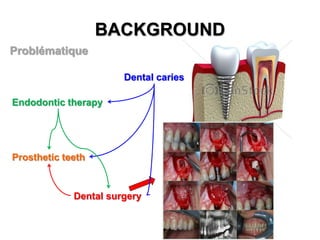 BACKGROUND
Problématique
Dental caries
Endodontic therapy

Prosthetic teeth

Dental surgery

 