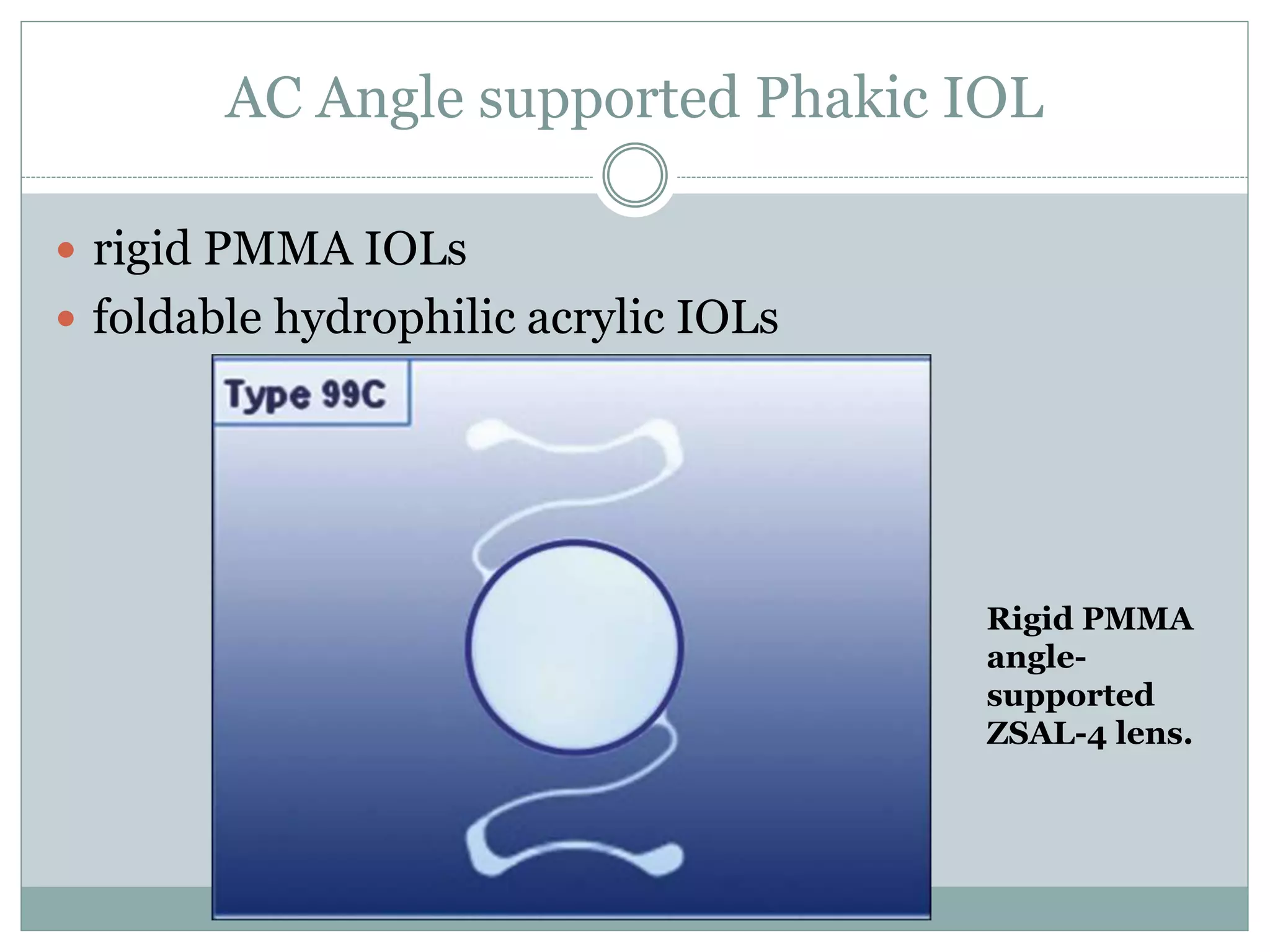 AC Angle supported Phakic IOL
 rigid PMMA IOLs
 foldable hydrophilic acrylic IOLs
Rigid PMMA
angle-
supported
ZSAL-4 lens.
 