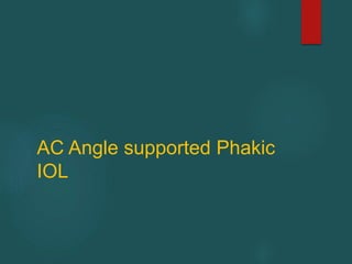 AC Angle supported Phakic
IOL
 