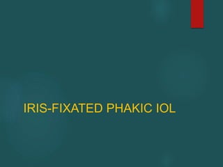 IRIS-FIXATED PHAKIC IOL
 