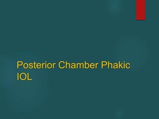 Posterior Chamber Phakic
IOL
 
