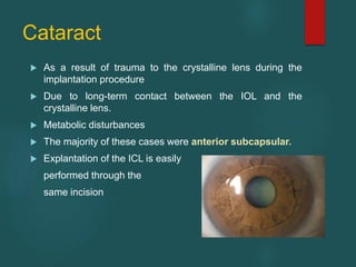 Cataract
 As a result of trauma to the crystalline lens during the
implantation procedure
 Due to long-term contact between the IOL and the
crystalline lens.
 Metabolic disturbances
 The majority of these cases were anterior subcapsular.
 Explantation of the ICL is easily
performed through the
same incision
 