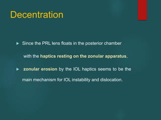 Decentration
 Since the PRL lens floats in the posterior chamber
with the haptics resting on the zonular apparatus,
 zonular erosion by the IOL haptics seems to be the
main mechanism for IOL instability and dislocation.
 