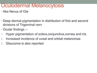 Oculodermal Melanocytosis
• Aka Nevus of Ota
• Deep dermal pigmentation in distribution of first and second
divisions of Trigeminal nerv
• Ocular findings :-
1. Hyper pigmentation of sclera,conjunctiva,cornea and iris
2. Increased incidence of uveal and orbital melanomas
3. Glaucoma is also reported
 