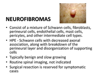 NEUROFIBROMAS
• Consist of a mixture of Schwann cells, fibroblasts,
perineural cells, endothelial cells, mast cells,
pericytes, and other intermediate cell types.
• HPE - Schwann cells with decreased axonal
association, along with breakdown of the
perineural layer and disorganization of supporting
cells
• Typically benign and slow growing
• Routine spinal imaging, not indicated
• Surgical resection is reserved for symptomatic
cases
 