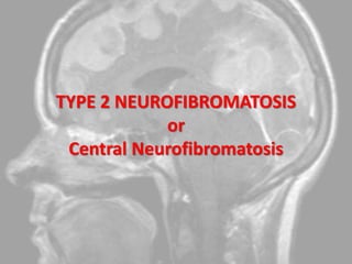 TYPE 2 NEUROFIBROMATOSIS
or
Central Neurofibromatosis
 