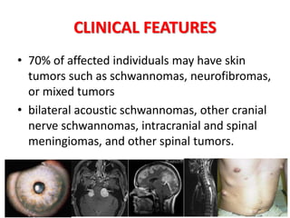 CLINICAL FEATURES
• 70% of affected individuals may have skin
tumors such as schwannomas, neurofibromas,
or mixed tumors
• bilateral acoustic schwannomas, other cranial
nerve schwannomas, intracranial and spinal
meningiomas, and other spinal tumors.
 