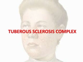 TUBEROUS SCLEROSIS COMPLEX
 