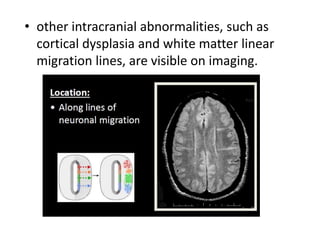 • other intracranial abnormalities, such as
cortical dysplasia and white matter linear
migration lines, are visible on imaging.
 