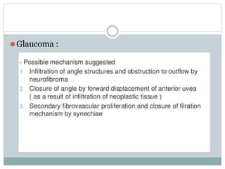 ⚫Glaucoma :
 
