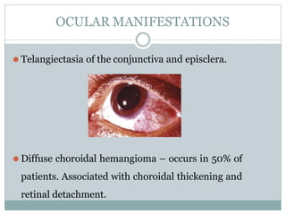 OCULAR MANIFESTATIONS
⚫ Telangiectasia of the conjunctiva and episclera.
⚫ Diffuse choroidal hemangioma – occurs in 50% of
patients. Associated with choroidal thickening and
retinal detachment.
 
