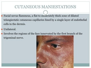 CUTANEOUS MANIESTATIONS
⚫ Facial nevus flammeus, a flat to moderately thick zone of dilated
telangiectatic cutaneous capillaries lined by a single layer of endothelial
cells in the dermis.
⚫ Unilateral.
⚫ Involves the regions of the face innervated by the first branch of the
trigeminal nerve.
 