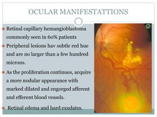 OCULAR MANIFESTATTIONS
⚫ Retinal capillary hemangioblastoma
commonly seen in 60% patients
⚫ Peripheral lesions hav subtle red hue
and are no larger than a few hundred
microns.
⚫ As the proliferation continues, acquire
a more nodular appearance with
marked dilated and engorged afferent
and efferent blood vessels.
⚫ Retinal edema and hard exudates.
 