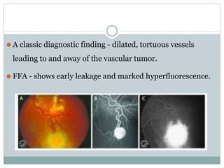 ⚫ A classic diagnostic finding - dilated, tortuous vessels
leading to and away of the vascular tumor.
⚫ FFA - shows early leakage and marked hyperfluorescence.
 