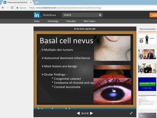 phakomatosesppt-170818165457.pptx