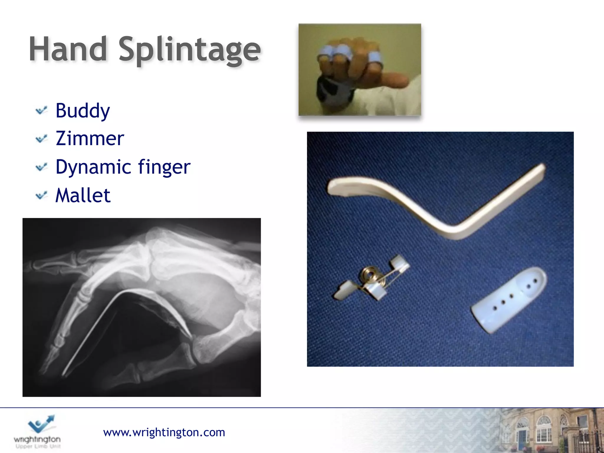 www.wrightington.com
Hand Splintage
Buddy
Zimmer
Dynamic finger
Mallet
 