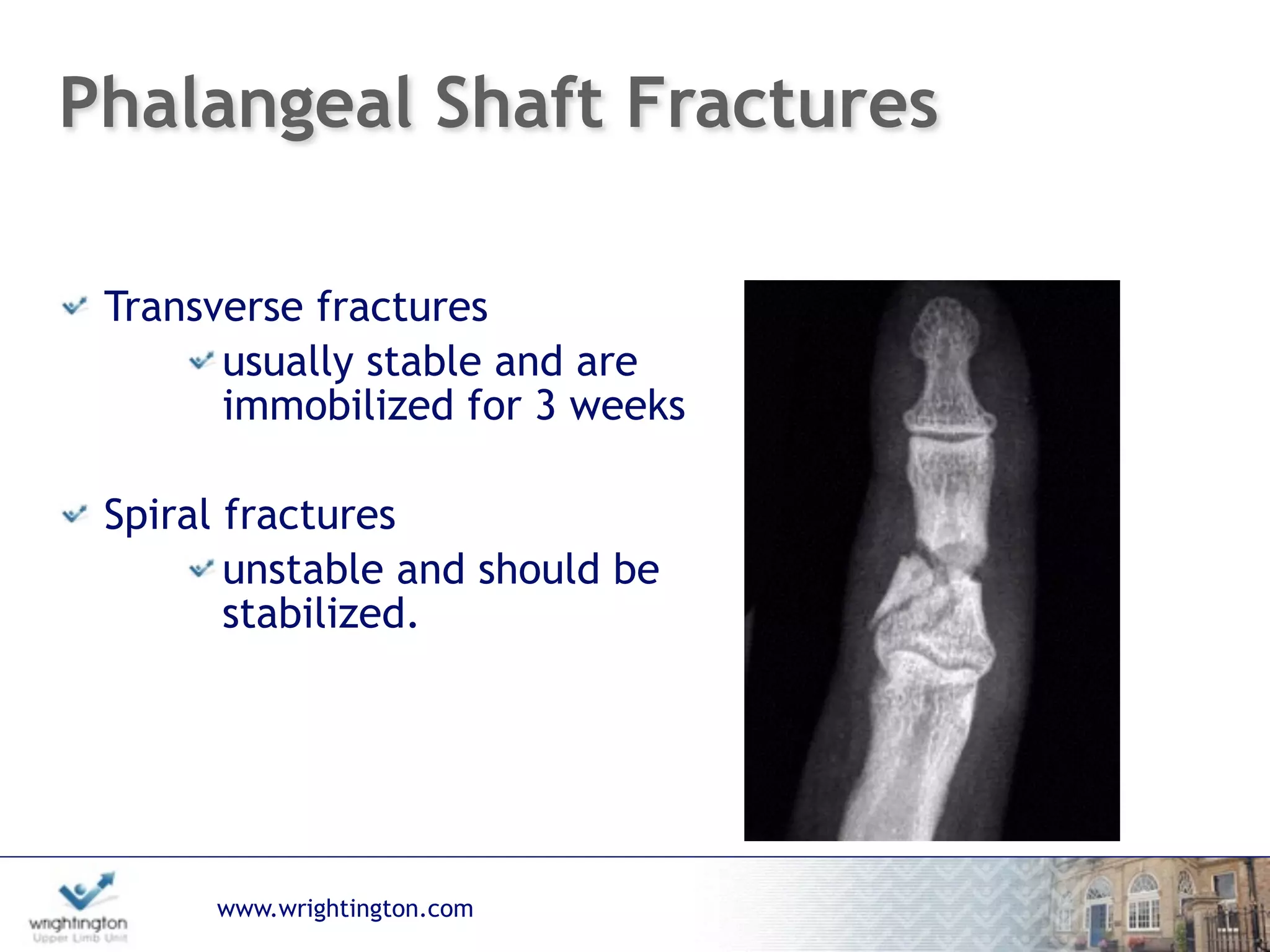 www.wrightington.com
Phalangeal Shaft Fractures
Transverse fractures
usually stable and are
immobilized for 3 weeks
Spiral fractures
unstable and should be
stabilized.
 