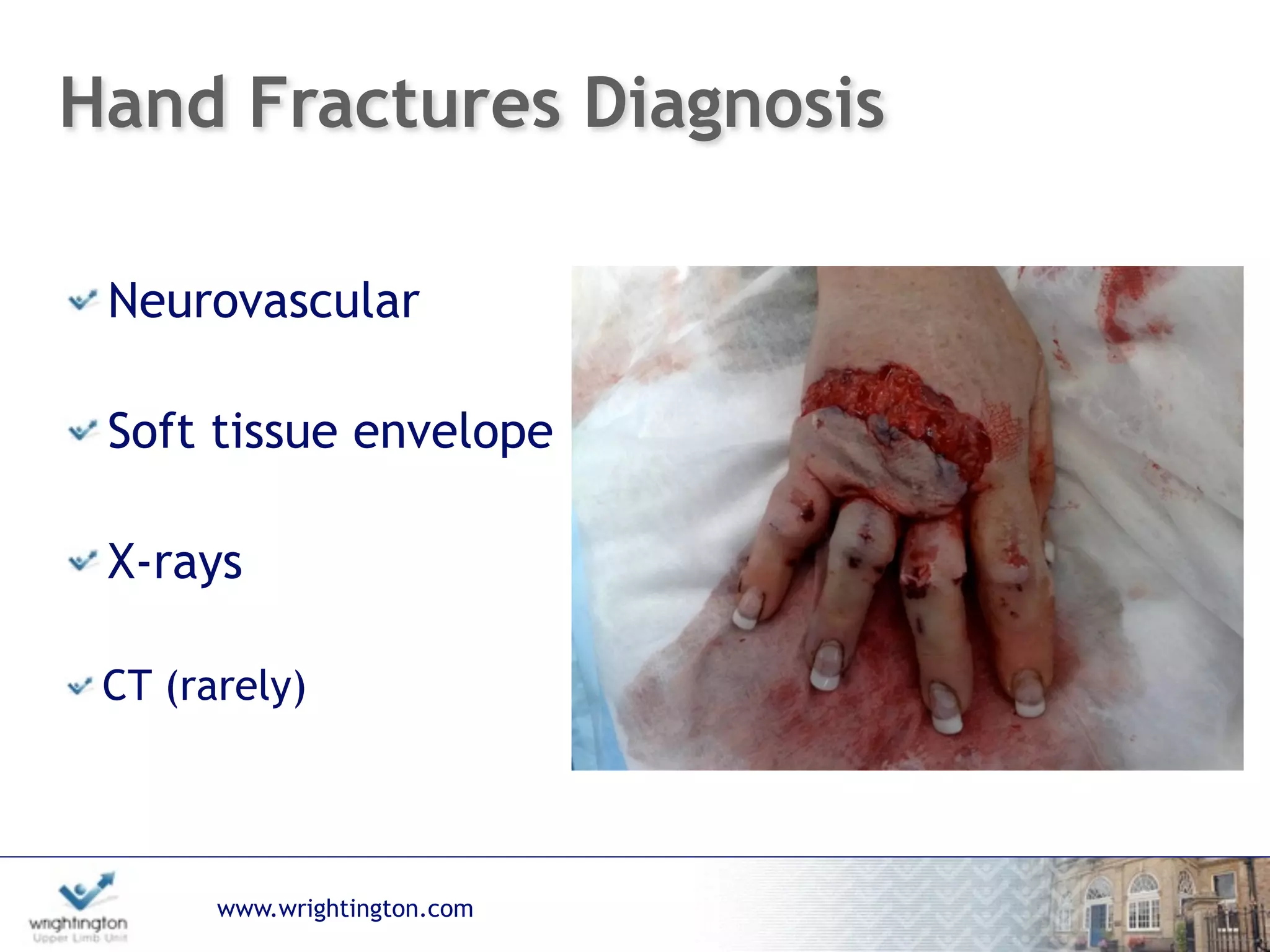 www.wrightington.com
Hand Fractures Diagnosis
Neurovascular
Soft tissue envelope
X-rays
CT (rarely)
 