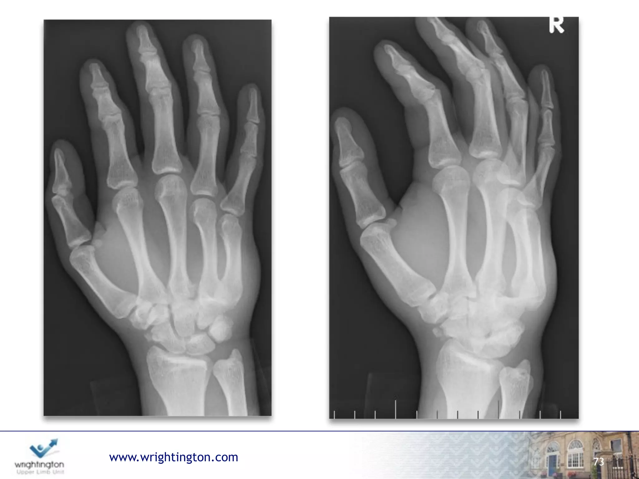 www.wrightington.com 73
 