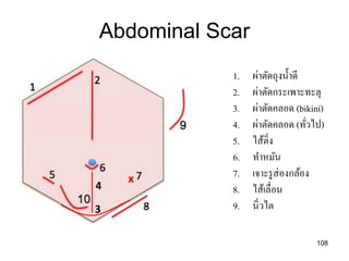 4
3
Abdominal Scar
108
1. ผ่าตัดถุงน้าดี
2. ผ่าตัดกระเพาะทะลุ
3. ผ่าตัดคลอด (bikini)
4. ผ่าตัดคลอด (ทั่วไป)
5. ไส้ติ่ง
6. ทาหมัน
7. เจาะรูส่องกล้อง
8. ไส้เลื่อน
9. นิ่วไต
 